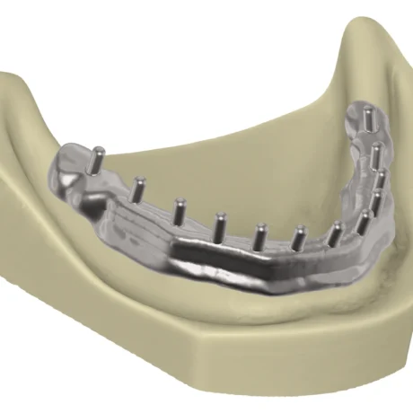 TianaDENT, produs pentru tehnică dentară
