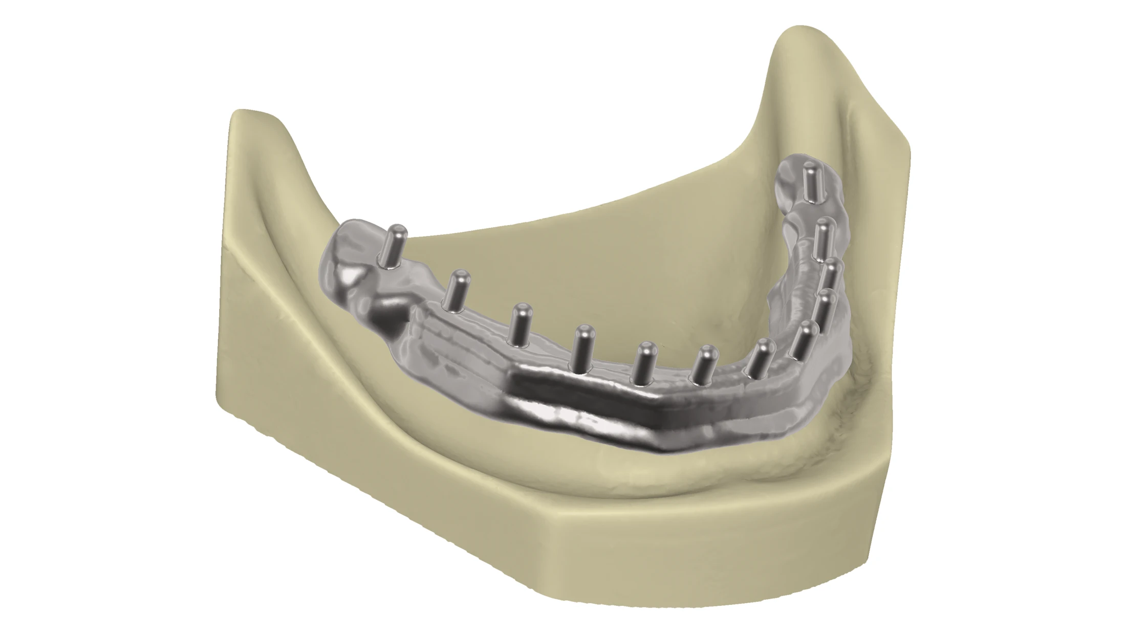 TianaDENT, produs pentru tehnică dentară