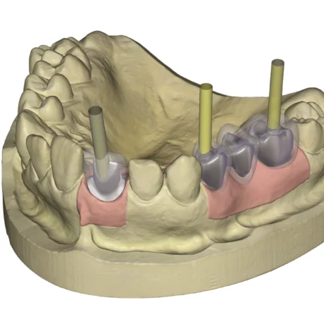 TianaDENT, produs pentru tehnică dentară