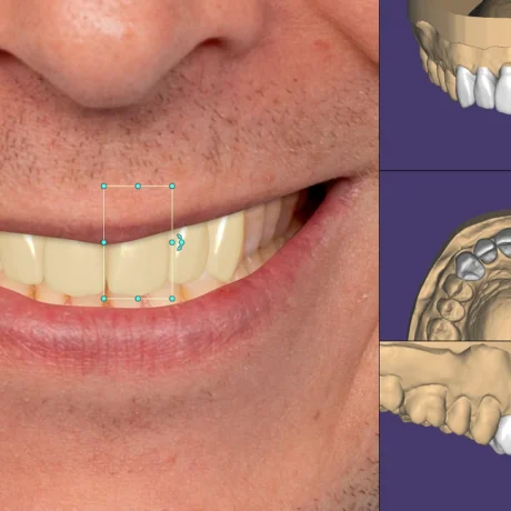 TianaDENT, produs pentru tehnică dentară