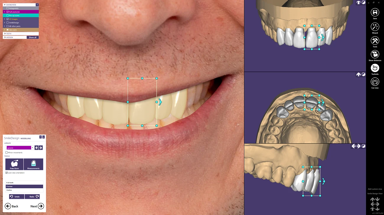 TianaDENT, produs pentru tehnică dentară
